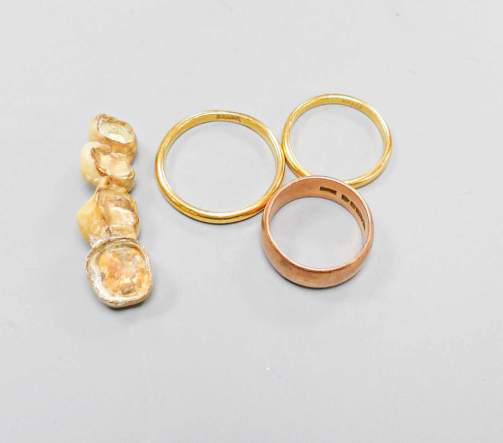 Two 22ct wedding rings, 5.7 grams, a 9ct rose gold wedding band 4.6 grams and four gold-mounted teeth.